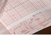 EKG-Karten DIN A5 quer, für 1-Kanal-Schreiber, gelocht